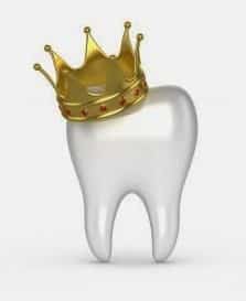 Tooth Crown Graphic