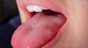 oral cancer causes and treatment Pleasant View UT Mountain View Dental
