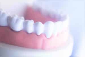 Mountain View Dental Gums Pleasant View UT