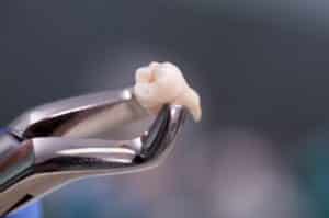 Pleasant View UT Mountain View Dental