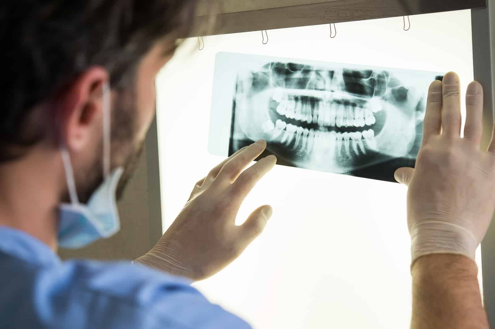 Dental X-Rays dental x-rays