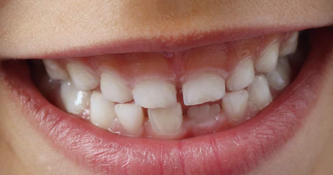 tooth emergency Pleasant View UT Mountain View Dental