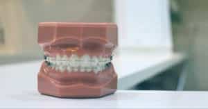 Mountain View Dental Bleeding Gums Pleasant View UT