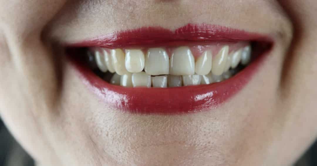 The Four Types of Teeth Pleasant View UT Mountain View Dental