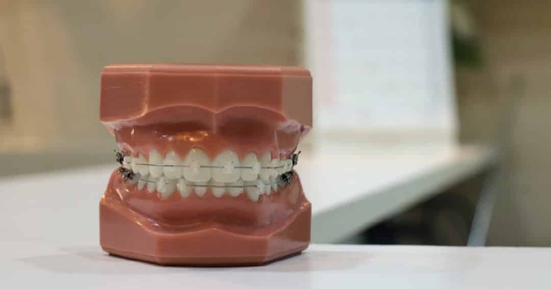 Can receding gums grow back Mountain View Dental Pleasant View UT