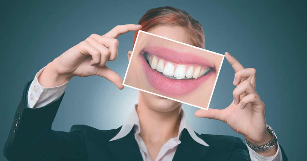 What to Know About Translucent Teeth Pleasant View UT Mountain View Dental