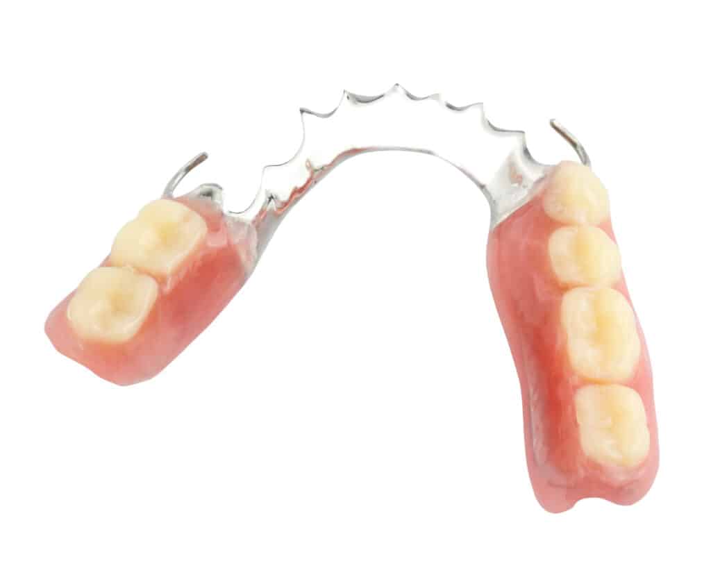 Partial Denture on white background. Finding the Right Dentures for You