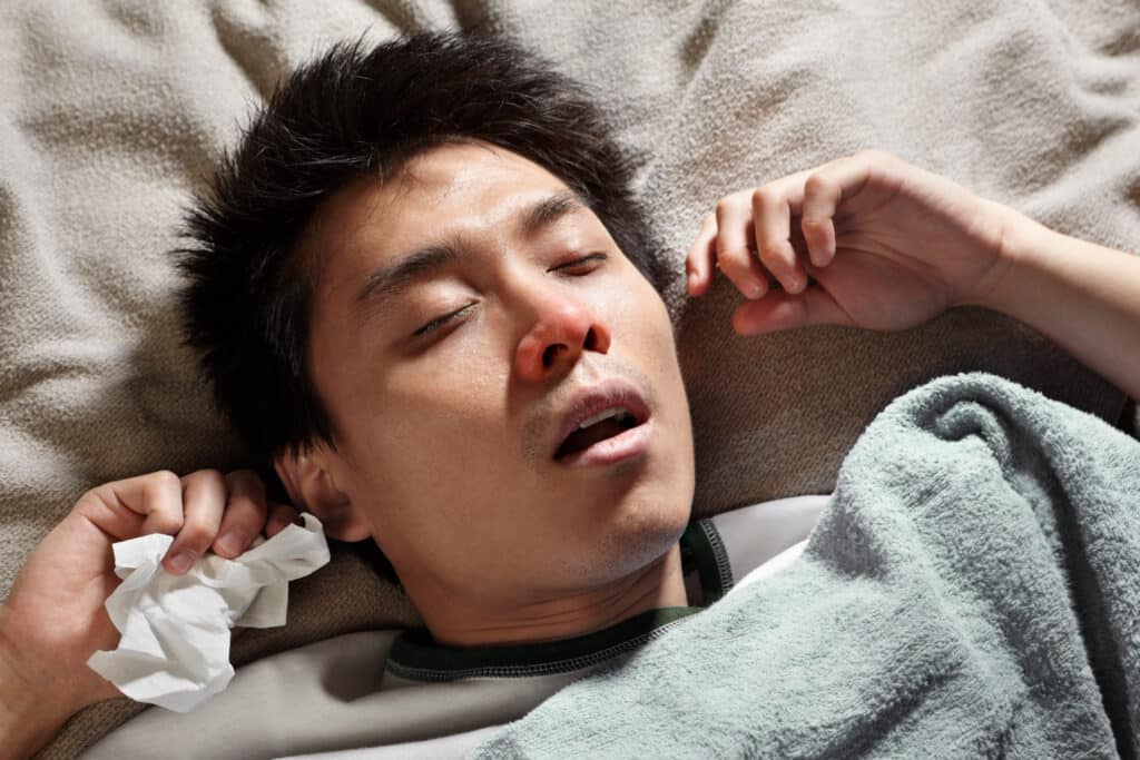 A male Chinese man is sleeping while catching cold and breathing through mouth because of the flu. Problems of Mouth Breathing