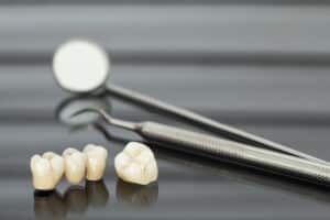 Catching Dental Crown Problems: The 6 Most Common Complications You May Experience Mountain View Dental Dental crowns Pleasant View, Utah