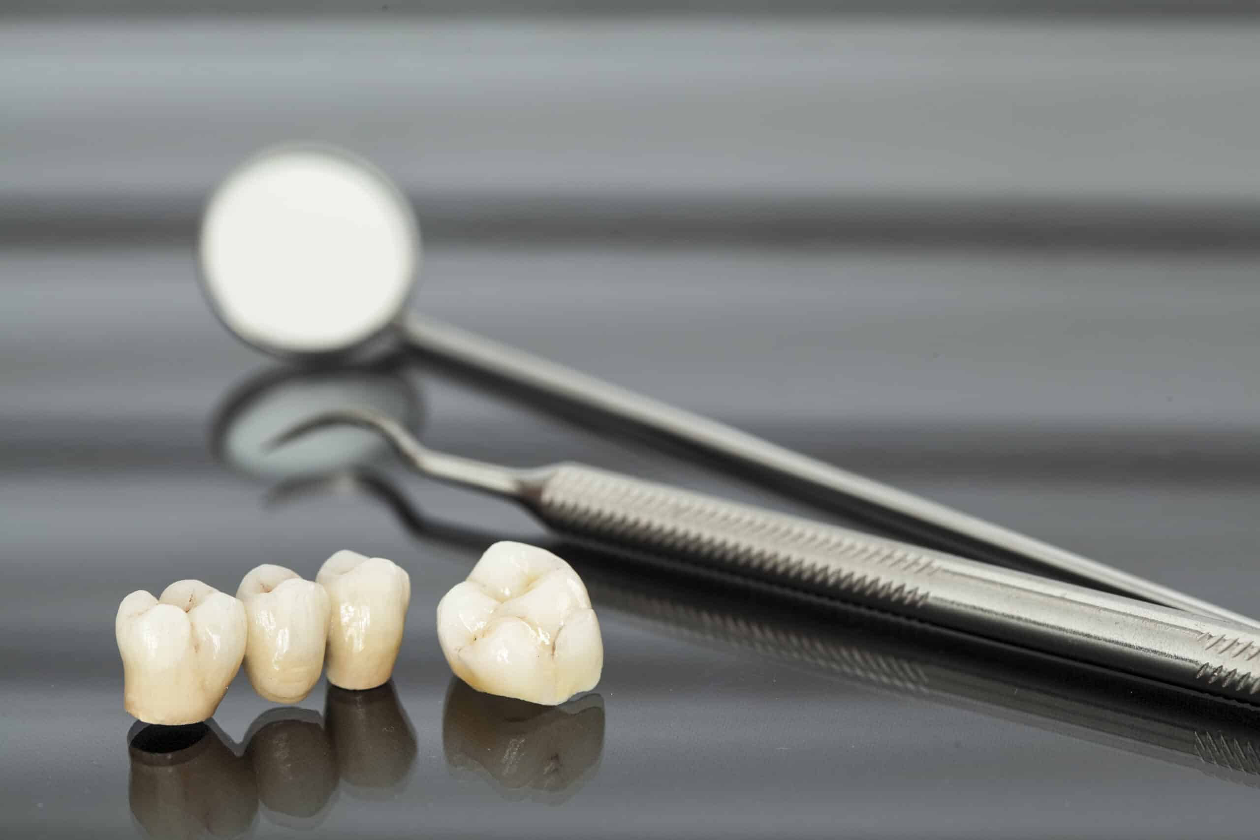 Dental crowns problems in Pleasant View, Utah