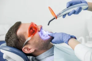 Professional teeth whitening in North Ogden, Utah