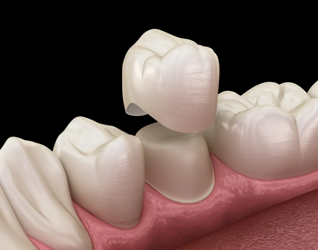 Dentist near me in Pleasant View