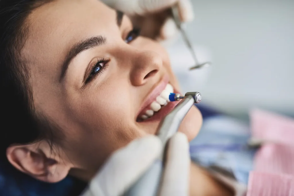 flouride treatment